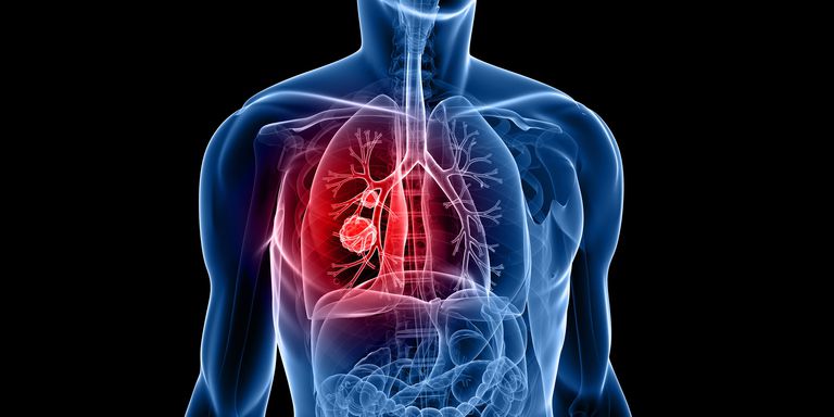 Cancer Prevalence and Treatment in India